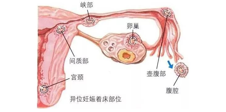 胚胎着床部位分析