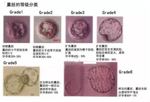 囊胚的治疗等级分类